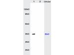 IL-17RB Antibody in Western Blot (WB)