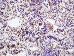 IL-17C Antibody in Immunohistochemistry (Paraffin) (IHC (P))