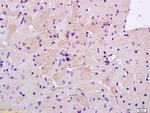 S100A13 Antibody in Immunohistochemistry (Paraffin) (IHC (P))