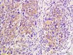 IL-21R Antibody in Immunohistochemistry (Paraffin) (IHC (P))