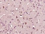 IL-22 Antibody in Immunohistochemistry (Paraffin) (IHC (P))