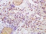 CD158 Antibody in Immunohistochemistry (Paraffin) (IHC (P))