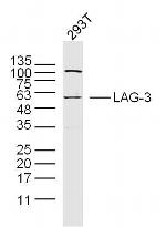 Lymphocyte Activation Gene 3 Antibody in Western Blot (WB)