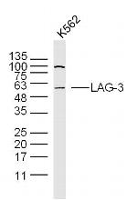 Lymphocyte Activation Gene 3 Antibody in Western Blot (WB)