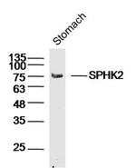 SPHK2 Antibody in Western Blot (WB)