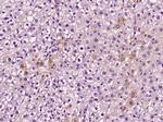 C5b-9 Antibody in Immunohistochemistry (Paraffin) (IHC (P))