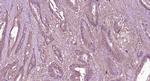 C5b-9 Antibody in Immunohistochemistry (Paraffin) (IHC (P))