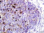 LRP1/CD91 Antibody in Immunohistochemistry (Paraffin) (IHC (P))