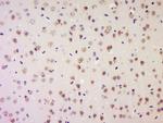 LRP1/CD91 Antibody in Immunohistochemistry (Paraffin) (IHC (P))