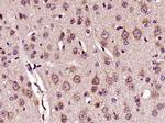 DKK3 Antibody in Immunohistochemistry (Paraffin) (IHC (P))