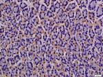 MCT4 Antibody in Immunohistochemistry (Paraffin) (IHC (P))