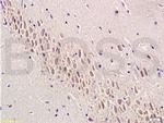 Semaphorin 7A Antibody in Immunohistochemistry (Paraffin) (IHC (P))