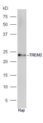 TREM2 Antibody in Western Blot (WB)