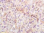 Phospho-IRS-1 (Ser307) Antibody in Immunohistochemistry (Paraffin) (IHC (P))