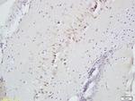 SLIT2/Slil3 Antibody in Immunohistochemistry (Paraffin) (IHC (P))