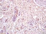 AMPK alpha 2 Antibody in Immunohistochemistry (Paraffin) (IHC (P))