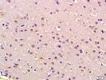 P105 RB Antibody in Immunohistochemistry (Paraffin) (IHC (P))