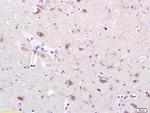 CACNA1G Antibody in Immunohistochemistry (Paraffin) (IHC (P))