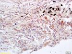 Jak3 Antibody in Immunohistochemistry (Paraffin) (IHC (P))