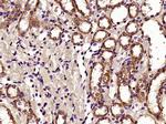 HDAC6 Antibody in Immunohistochemistry (Paraffin) (IHC (P))