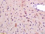 JNK1/2 Antibody in Immunohistochemistry (Paraffin) (IHC (P))