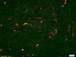 Lyn Antibody in Immunohistochemistry (Paraffin) (IHC (P))