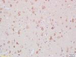 MARCKS Antibody in Immunohistochemistry (Paraffin) (IHC (P))