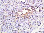 RAP1GAP Antibody in Immunohistochemistry (Paraffin) (IHC (P))