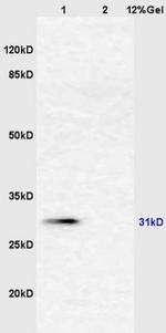 AHSG Antibody in Western Blot (WB)