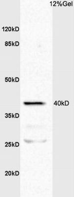 TNFR1 Antibody in Western Blot (WB)