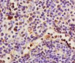 HAS1 Antibody in Immunohistochemistry (Paraffin) (IHC (P))