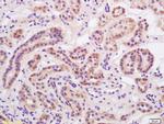 Alpha-ENaC Antibody in Immunohistochemistry (Paraffin) (IHC (P))