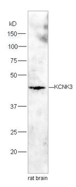 KCNK3 Antibody in Western Blot (WB)