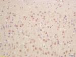 HES1 Antibody in Immunohistochemistry (Paraffin) (IHC (P))