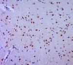 HES1 Antibody in Immunohistochemistry (Paraffin) (IHC (P))