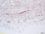 Factor 8 Antibody in Immunohistochemistry (Paraffin) (IHC (P))