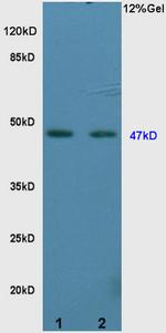 Vitamin D Receptor/VDR Antibody in Western Blot (WB)