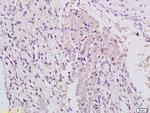 MLK3 Antibody in Immunohistochemistry (Paraffin) (IHC (P))