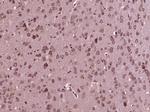 MLK3 Antibody in Immunohistochemistry (Paraffin) (IHC (P))