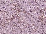 MLK3 Antibody in Immunohistochemistry (Paraffin) (IHC (P))