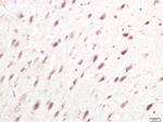 IRF7 Antibody in Immunohistochemistry (Paraffin) (IHC (P))