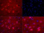 Phospho-Bax (Ser184) Antibody in Immunohistochemistry (Paraffin) (IHC (P))