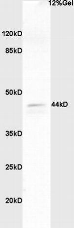 Phospho-ERK1/2 (Thr202, Tyr204) Antibody in Western Blot (WB)