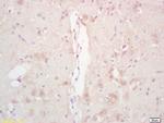 Phospho-Acetyl CoA Carboxylase (Ser79) Antibody in Immunohistochemistry (Paraffin) (IHC (P))