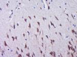 Phospho-Acetyl CoA Carboxylase (Ser79) Antibody in Immunohistochemistry (Paraffin) (IHC (P))