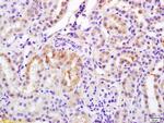 Phospho-Bcl-2 (Ser70) Antibody in Immunohistochemistry (Paraffin) (IHC (P))