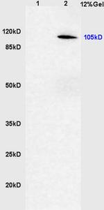 Phospho-CYLD (Ser418) Antibody in Western Blot (WB)