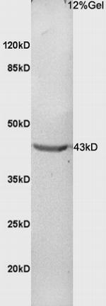 Phospho-CDK9 (Thr186) Antibody in Western Blot (WB)