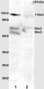 Phospho-FAK (Tyr397) Antibody in Western Blot (WB)