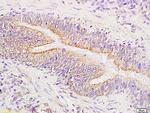 Phospho-FAK (Tyr576, Tyr577) Antibody in Immunohistochemistry (Paraffin) (IHC (P))